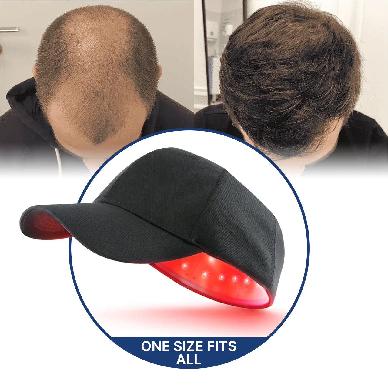 Regrow your hair in 120 days using the Laser Cap, or get a full refund