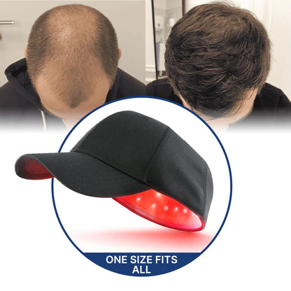 Regrow your hair in 120 days using the Laser Cap, or get a full refund