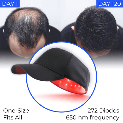 Regrow your hair in 120 days using the Laser Cap, or get a full refund